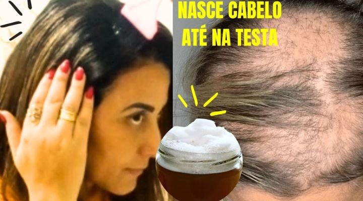 Crescimento capilar natural