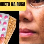 Rejuvenescimento facial natural