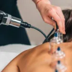Curso de Ventosaterapia